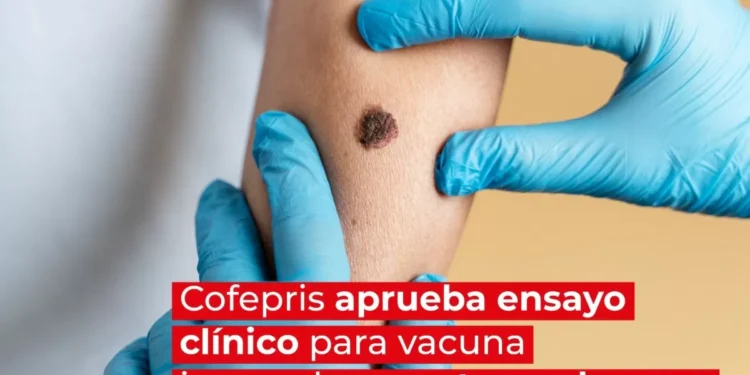 Cofepris autoriza ensayo clínico para vacuna innovadora contra melanoma