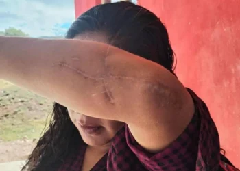 ‘Temo por mi historia, un juez liberó a quien quiso matarme’: mixteca víctima de intento de feminicidio