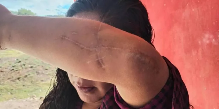 ‘Temo por mi historia, un juez liberó a quien quiso matarme’: mixteca víctima de intento de feminicidio